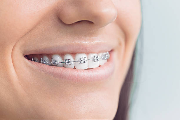 Best Veneers and Lumineers  in Stockdale, TX